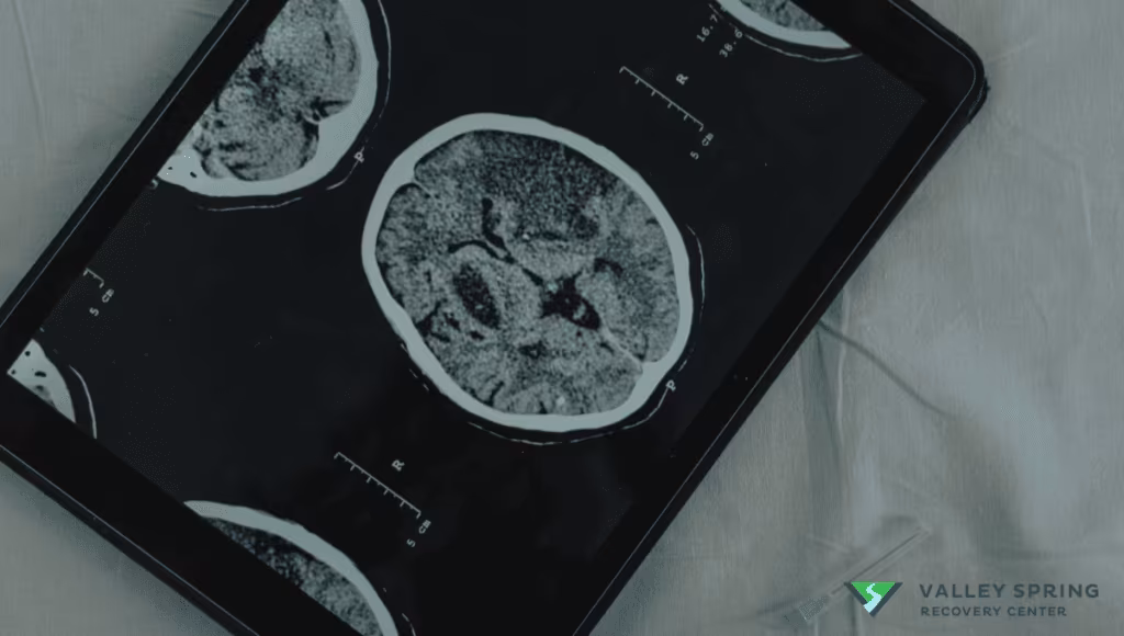 science behind addiction