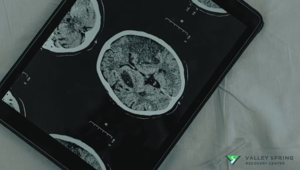 science behind addiction