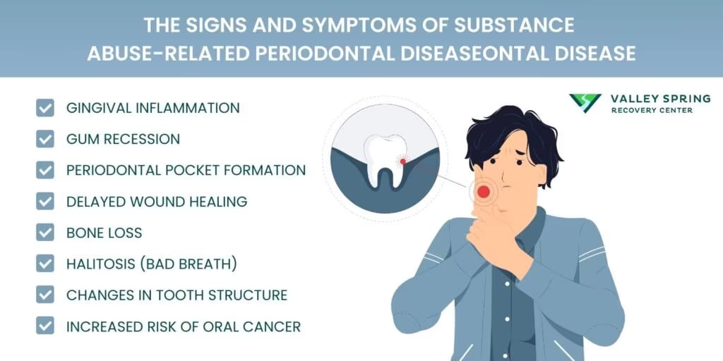 The Signs and Symptoms of Substance Abuse Related Periodontal Disease