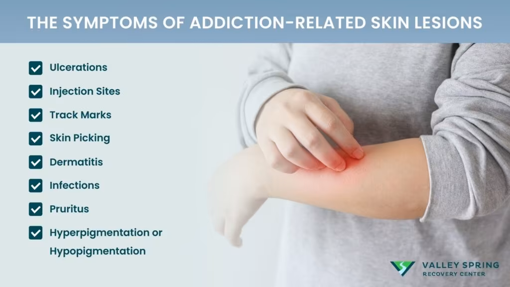 The Symptoms of Addiction-related Skin Lesions