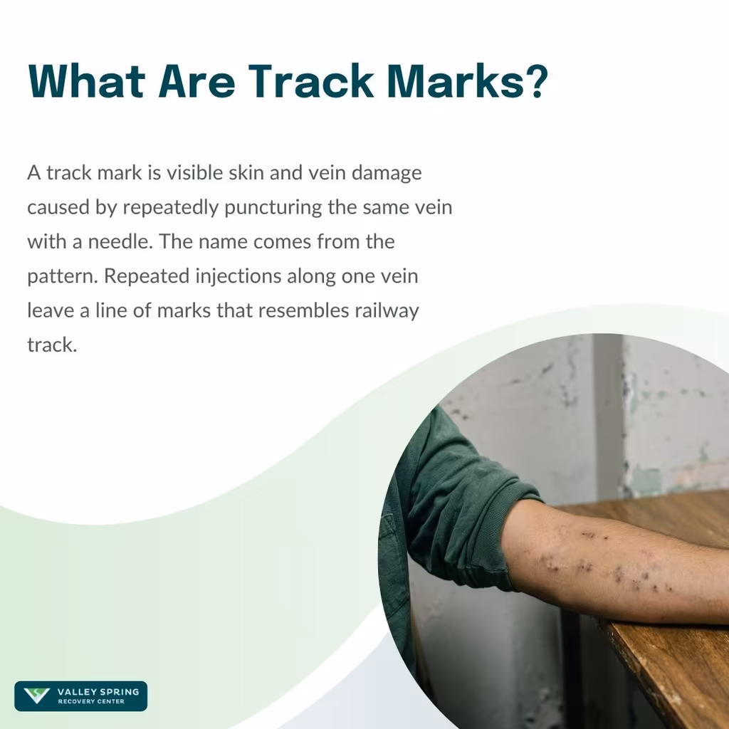 What are track marks — repeated needle injection marks along a vein on the forearm