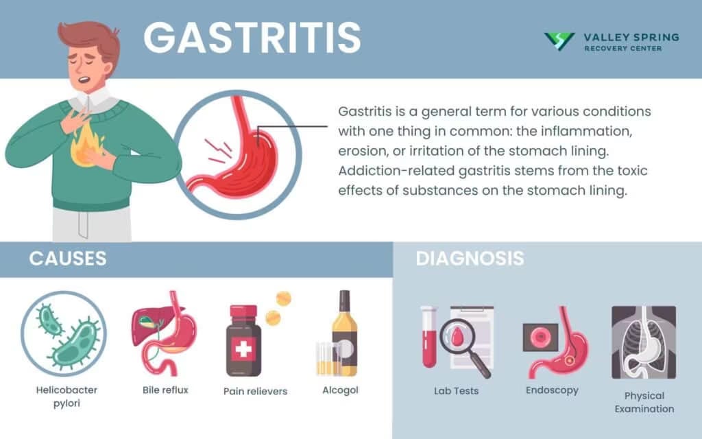 Addiction and Gastritis: A Comprehensive Study