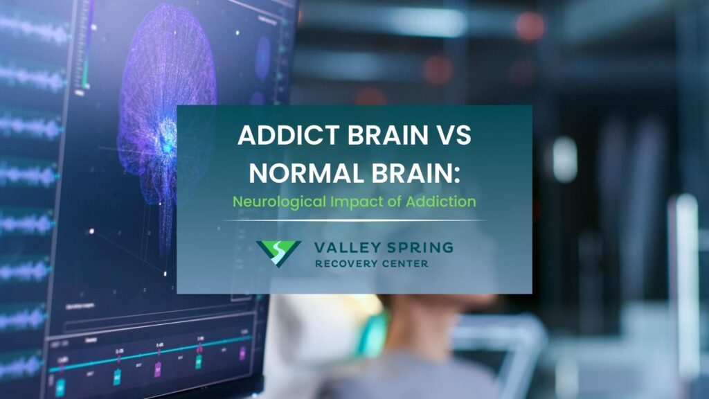 addict brain vs normal brain